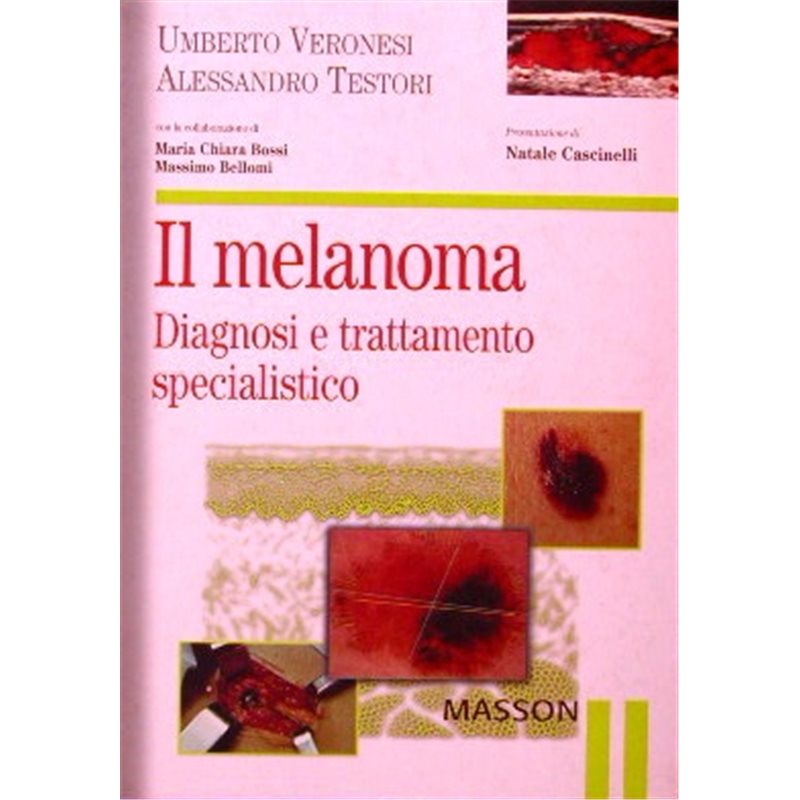 Il melanoma